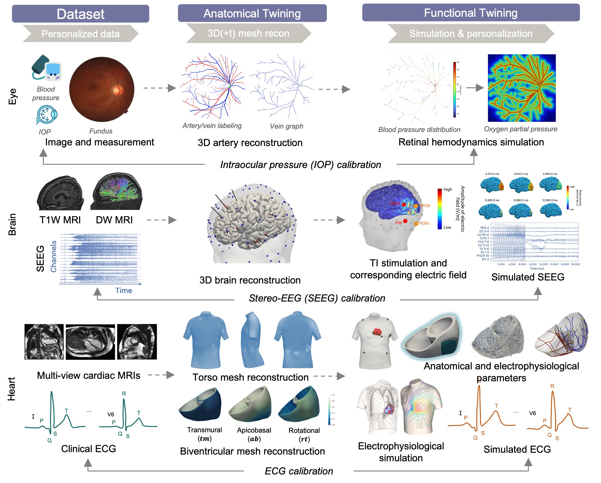 Building Digital Twins of Different Human Organs for Personalized ...