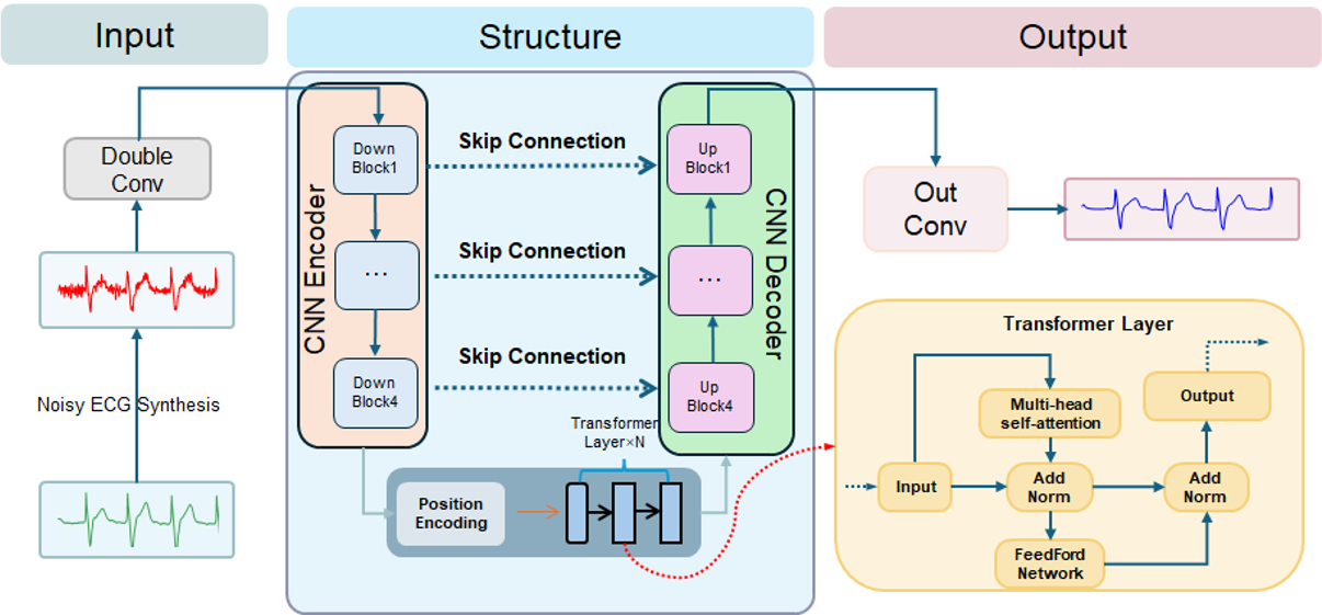 TF-TransUNet1D: Time-Frequency Guided Transformer U-Net for Robust ECG ...