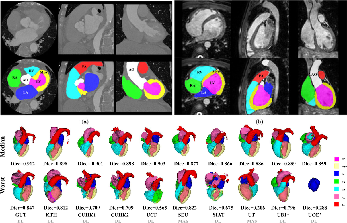 Evaluation Of Algorithms For Multi-Modality Whole Heart Segmentation ...